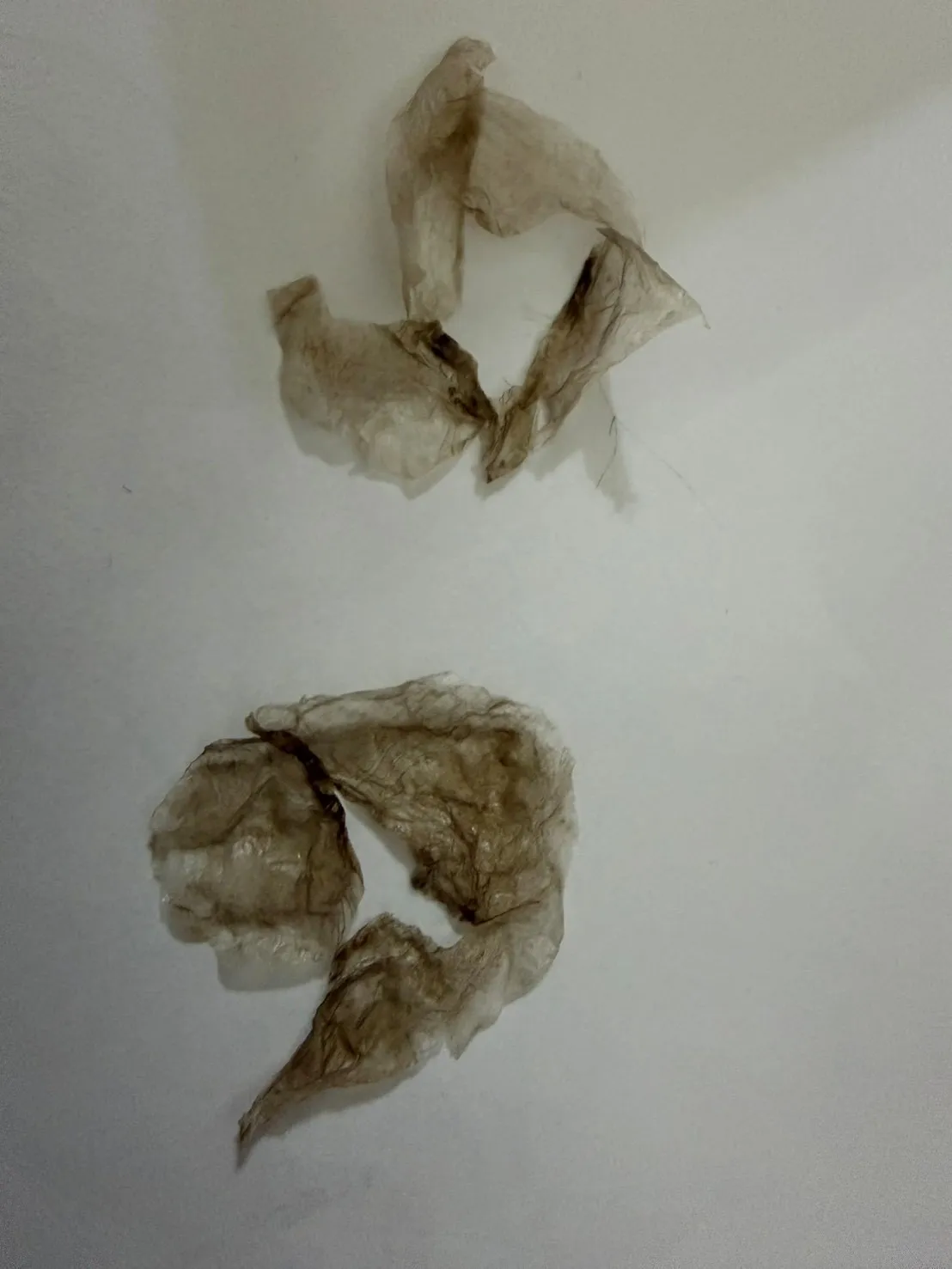 ローマピンク名古屋正規導入店/モニターキャンペーン!40%OFF/ローマピンク皮剥け